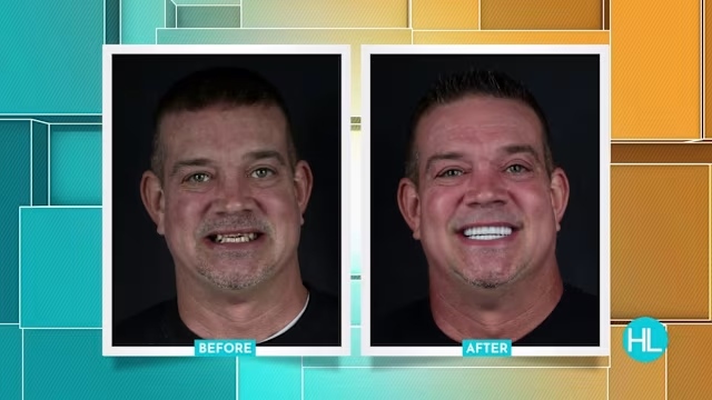Houston Life: Smile Makeover Transformation Results
