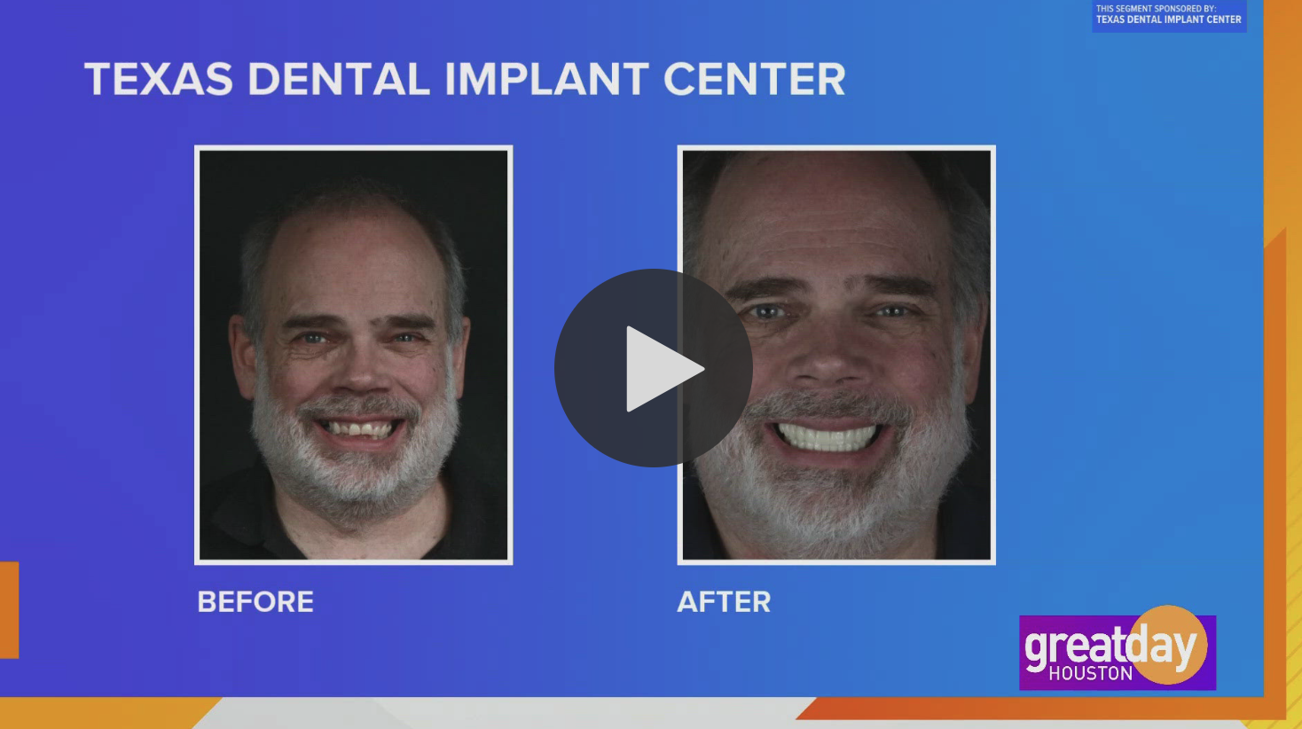 Learn about Texas Dental Implant Center on Local Spotlight